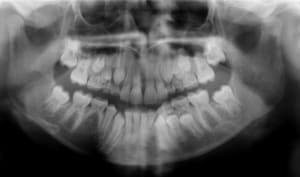 Garcon 11 ans rxiplw - Eugenol