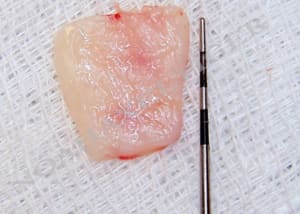 Greffon yoownt - Eugenol