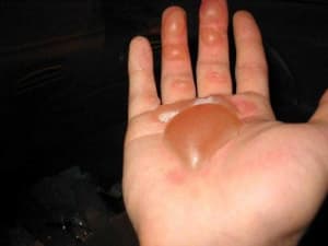 Grosse ampoule woe7it - Eugenol