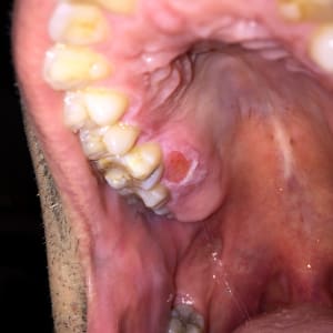 Gxwjbyvbq0plhppggtyk - Eugenol