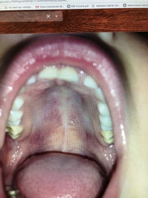 Hllog0mvm0xxbi1atxl6 - Eugenol