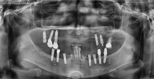 Hwwu0dhx4mogqem9xvcv5jxldduf - Eugenol
