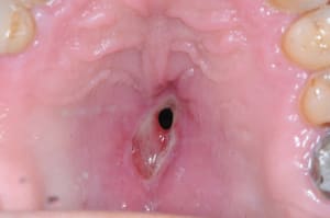 Ilhyagpdibdd7dbmgbld - Eugenol