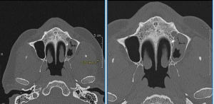 Image002 zvcmaq - Eugenol