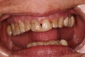 Img1 s0wljt - Eugenol