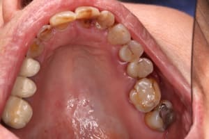 Img3 paoaxe - Eugenol