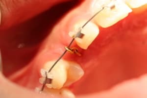 Img 0525 taggan - Eugenol