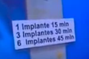 Implant cha ne esapgne yzgpos - Eugenol