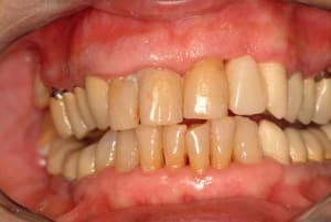 Initial bblioo - Eugenol