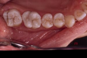 Intégration dhfgqv - Eugenol