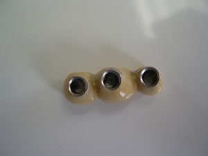 Intrados prothèse vb2ocr - Eugenol