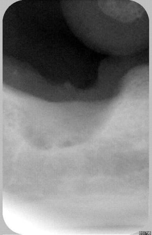 Itou m0p00m - Eugenol