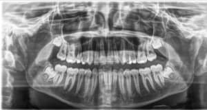 Ivp007xoi6bck6m1i1zl - Eugenol