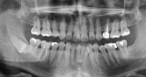 Iyi6ax3laywt9fj8x9x51n3rlbzs - Eugenol