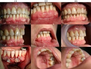 J0 j15 j21 x5fidd - Eugenol