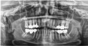 Jqx5bdzbqeukqplqmdod - Eugenol