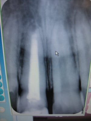L o 2010 hvacnk - Eugenol