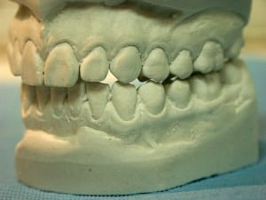 Latgauche1 yirlwq - Eugenol