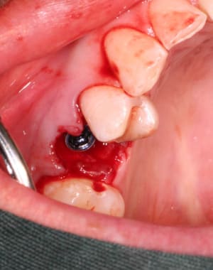 Lavis yddv4m - Eugenol