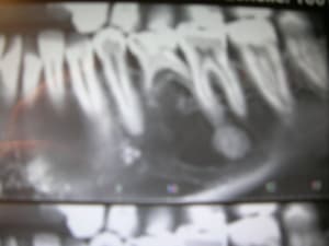 Lb8yiwwn7lqhvoa0tpsk - Eugenol