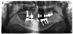 Lioa5b9r8yamcpj8gxku - Eugenol