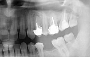 Lipd1vvny60ge6mky0ts - Eugenol