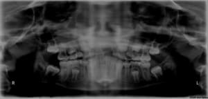 M3 offs3e - Eugenol
