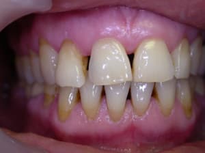 Madame t5atb xw6lpz - Eugenol