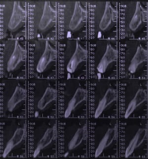 Mfscan1 uqx92g - Eugenol