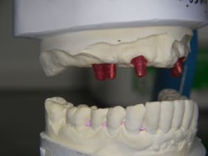 Modele de finition lopizu - Eugenol