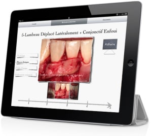 Montage imuco ipad 3 dtmmts - Eugenol