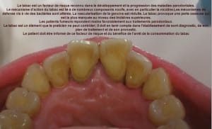Motivation m1n3sl - Eugenol