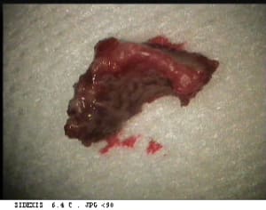 Necrose1 ynuwk8 - Eugenol