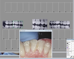 Orkgx8ejmuyjsbi5udws - Eugenol