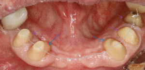 Oyfc107y5bga5qw0rdpmc2ah78l3 - Eugenol