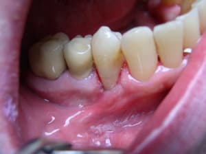 P1010067 rtdfyf - Eugenol