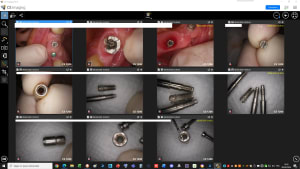 P79p1f25k6pja04y7dvxdwl6zg4e - Eugenol