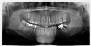 Pano1 bd70lz - Eugenol