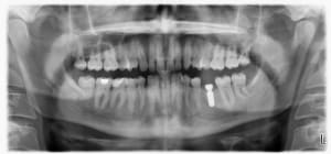 Pano1 nft64f - Eugenol