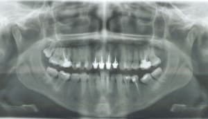 Pano2 m6d6rn - Eugenol