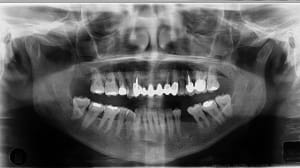 Panoargttt ip0d5q - Eugenol