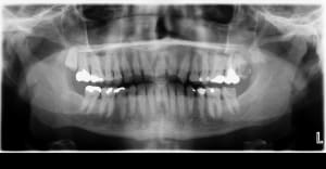 Pano ftrqey - Eugenol