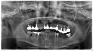 Pano h7svml - Eugenol