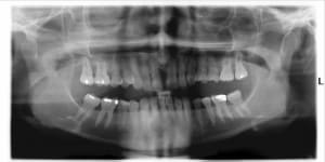 Pano y7vfr0 - Eugenol