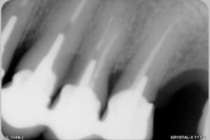 Parodo 2  1  ozrb8y - Eugenol