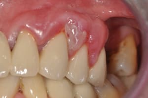 Parodo 2 ztjvzz - Eugenol