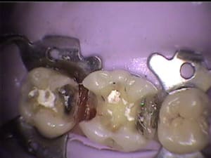 Pendant m8mpti - Eugenol