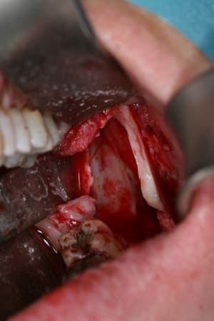 Per op4 hlpysy - Eugenol