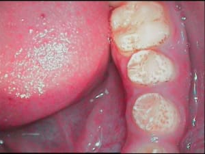 Petite 1 stxc9e - Eugenol