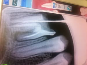 Photo 1 pl4wpt - Eugenol